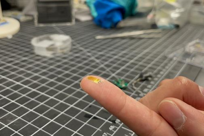 El diminuto implante para medir la temperatura es blando y flexible, y se adapta a los tejidos del riñón.