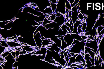 Vista de microscopio fluorescente de Taurinivorans muris ("devorador de taurina del ratón") en cultivo axénico