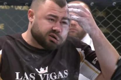 En una competencia en enero, el rumano Sorin Comsa no se dejó ganar en una competencia de bofetadas, terminando con el rostro hinchado y ensangrentado