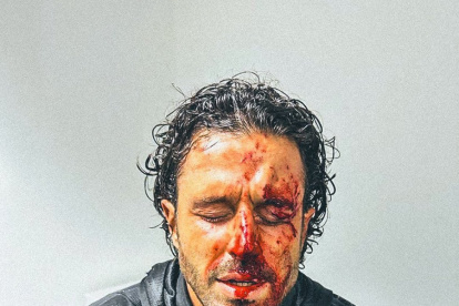 Hirieron en la cabeza al técnico visitante, el italiano Fabio Grosso.