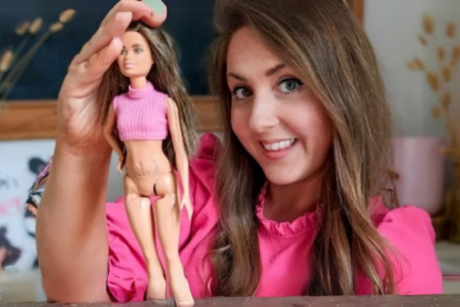 Kate Claxton, diseño una muñeca Barbie con estrias