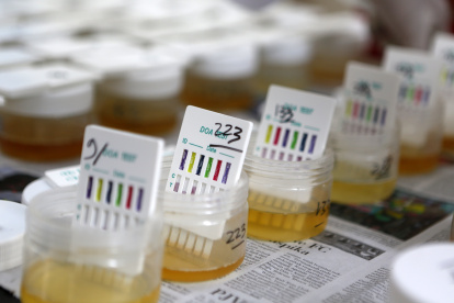 Muestras de orina