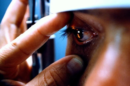 Situación. El queratocono es una enfermedad rara en las córneas del ojo.