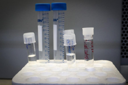 Estudio.- El bisfenol, un químico escondido con consecuencias para la salud.