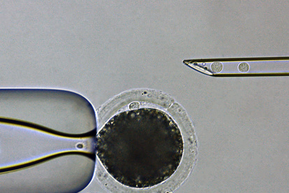 Proceso de clonación de un cerdo modificado genéticamente para reducir el riesgo de rechazo por parte de un receptor humano en un xenotrasplante.