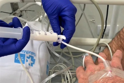 Proceso. Después de la sedación, el paciente podría sentir ciertos mareos