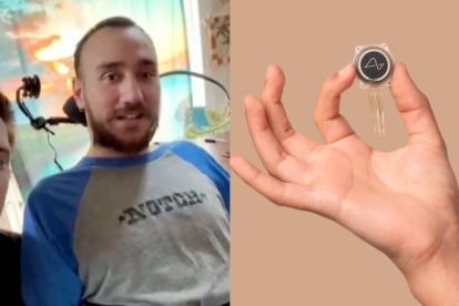 Noland Arbaugh, un hombre con parálisis, se ha convertido en el primer humano en implantarse uno de los prototipos de Neuralink