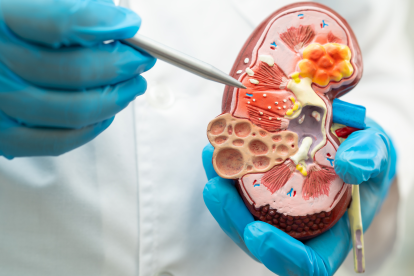 Referencial de riñón.