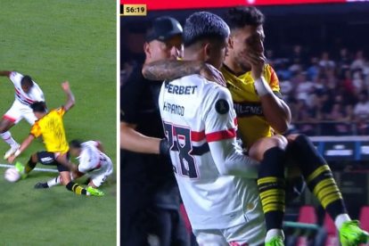 Joao Rojas sufrió una fractura de tibia.