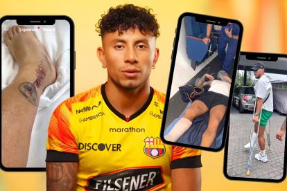 A Joao Rojas se le sacaron los puntos y ahora viene la recuperación.