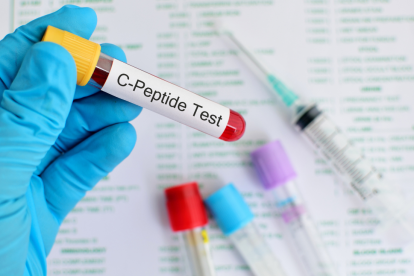 Referencial. Una de las áreas más prometedoras de la investigación del TB-500 reside en su posible implicación en la cicatrización de heridas