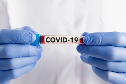 La variante de la COVID-19, FLiRT ya está en Ecuador; estos son sus síntomas.