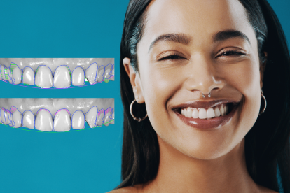 El diseño de sonrisa es un tratamiento personalizado combina tecnología avanzada con técnicas estéticas.