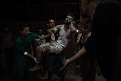 Palestinos heridos en un ataque israelí al este de Khan Younis llegan al hospital Nasser, al sur de la franja de Gaza. EFE/HAITHAM IMAD