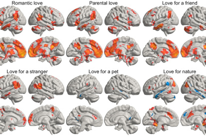La imagen representa una media estadística de cómo los diferentes tipos de amor "iluminan" distintas regiones del cerebro.