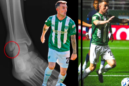 Damián Díaz tiene una lesión del maléolo externo.