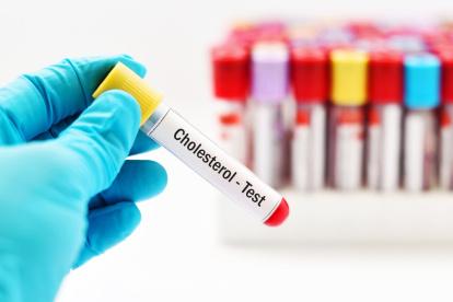 Descubre qué niveles de colesterol deberías tener según tu edad.