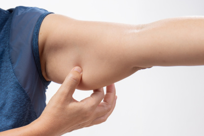 A partir de los 50 años, mantener los brazos firmes y definidos puede convertirse en un desafío.