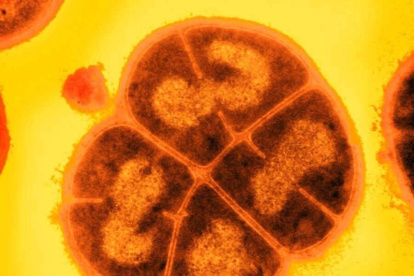Apodada «la bacteria Conan» por su extraordinaria capacidad para tolerar las condiciones más duras, Deinococcus radiodurans puede soportar dosis de radiación miles de veces superiores a las que matarían a un ser humano. EFE/Crédito: USU/