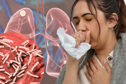 Grafico referente a tuberculosis