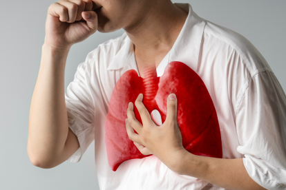 Referencial. La tuberculosis afecta principalmente los pulmones