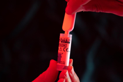 En la imagen de archivo, una persona se realiza una prueba rápida, anónima y gratuita de VIH. EFE/Biel Aliño