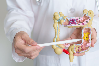 Salud. El Síndrome de Intestino Irritable cada vez es más común en Ecuador, en especial en las mujeres.