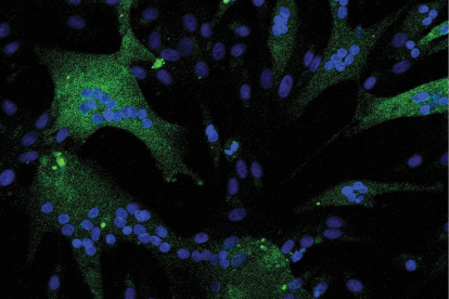 El estudio molecular de la fibra muscular de un caballo de carreras pura sangre ha revelado una adaptación genética para hacerle más atlético. EFE/Crédito