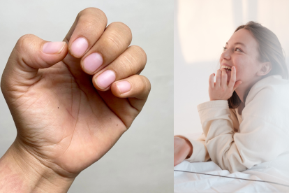 Un hábito común como morderse las uñas puede traer problemas de salud a las personas
