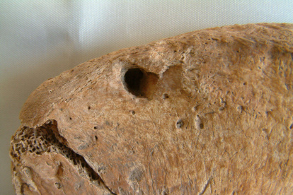 Marca de diente de león en el hueso de la cadera. Crédito: Maynooth University