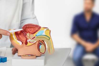 Mitos impiden detección oportuna del cáncer de próstata