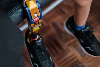 En Ecuador, miles aún esperan una prótesis, ROMP trabaja para que no sea un privilegio.