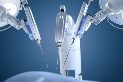 Imagen referencial. Cirugía robótica.