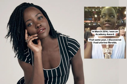 Lupita Nyong"o habla sobre su fibrosis uterina