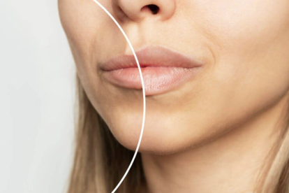 Los biopolímeros fueron aplicados durante años en procedimientos estéticos sin regulación clara. Hoy, su retiro se convierte en una necesidad médica urgente para cientos de mujeres.