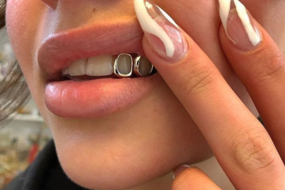 Los grillz son una moda que puede poner en riesgo la salud bucal.