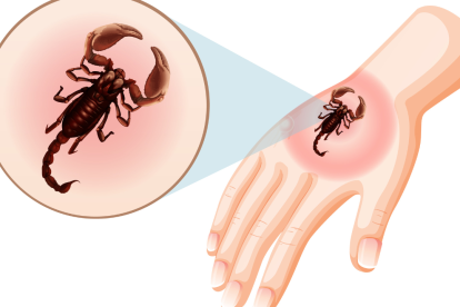 Imagen simbólica de picadura de alacrán.