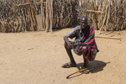 Ekai Akumal Losike, padece de micetoma en una aldea situada alrededor de una hora y media de Todwar, capital del condado keniano de Turkana.