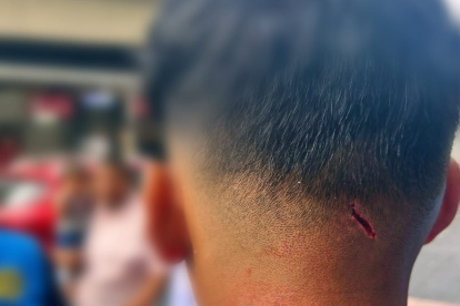 Herida del agente municipal afectado.