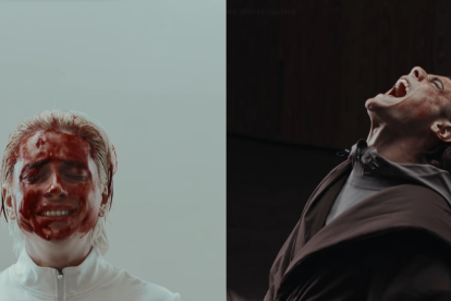 En la historia, el tratamiento de Sting comprende 12 pasos.