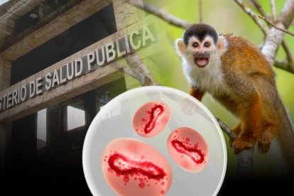 Viruela del mono mantiene en alerta al sistema de salud pública