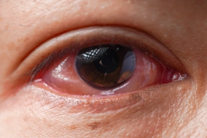 El CMNV deja el océano y entra en la salud humana.