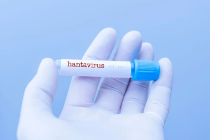 Muestra etiquetada como hantavirus en laboratorio, en medio de la alerta sanitaria internacional por posibles brotes.