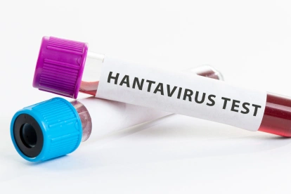 Referencial. Muestras de laboratorio utilizadas en pruebas para detectar hantavirus.