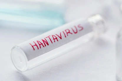 Autoridades sanitarias investigan posibles contagios de hantavirus ligados al crucero neerlandés Hondius.