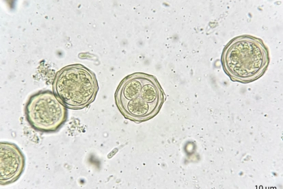Oocistos de Cryptosporidium, parásito responsable de brotes de diarrea en EE. UU.