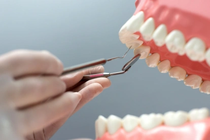 El programa de implantes dentales gratuitos, de la Universidad Católica de Santiago de Guayaquil (UCSG) tendrá 40 cupos.