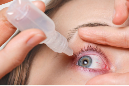 La conjuntivitis también es conocida coloquialmente como patada china.