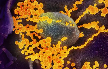 imagen de microscopio electrónico que muestra (objetos en amarillo) al SARS-CoV-2, el virus que causa el brote del coronavirus COVID-19