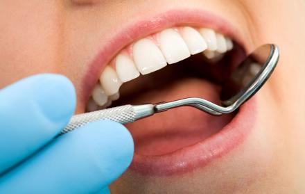 Estudios anteriores habían hablado de la relación de la gingivitis con el alzhéimer, pero esta vez se confirmó esta teoría a través de pruebas de ADN.
